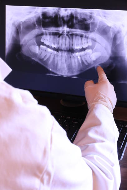 Best Emergency Broken Tooth Repair in Scottdale, GA