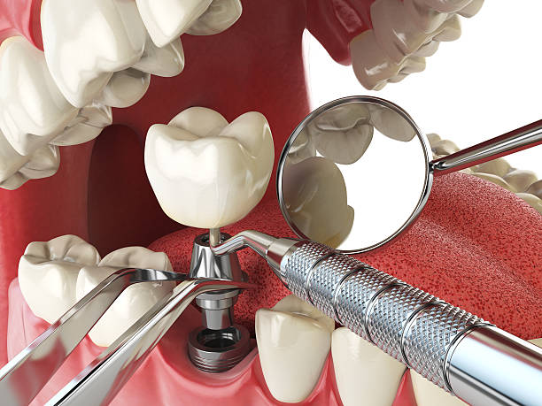 Best Emergency Root Canal Treatment in Scottdale, GA